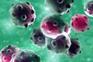 Alternative Treatments for Cancer