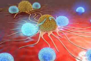 Cancer